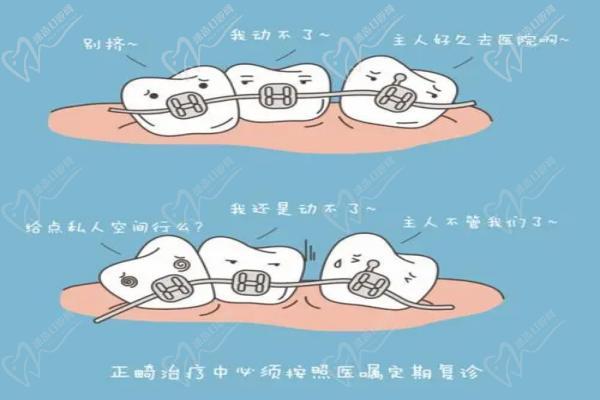 矯正器佩戴不恰當(dāng)危害大