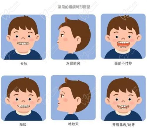 兒童早期矯正