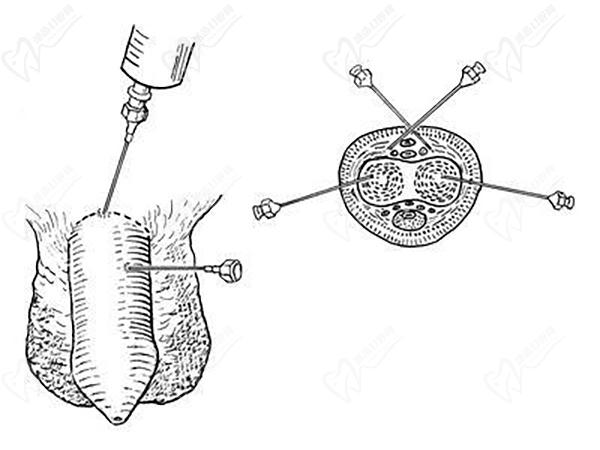 重慶星榮整形外科醫(yī)院男科手術(shù)優(yōu)勢