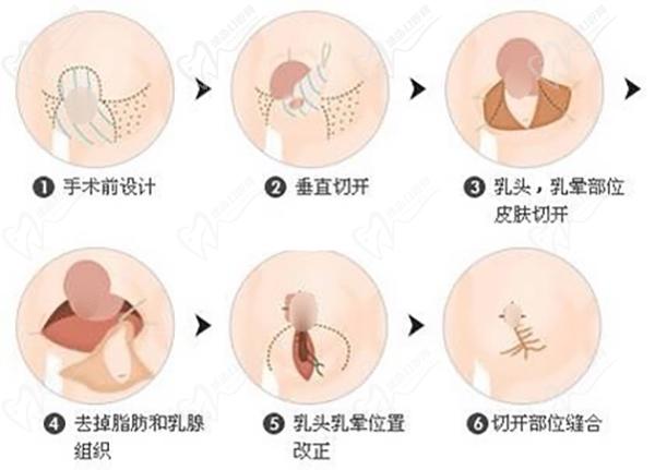 2024北京聯(lián)合麗格醫(yī)院微整注射收費(fèi)標(biāo)準(zhǔn)