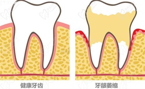 牙齒松動(dòng)怎么辦