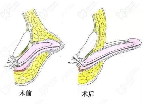 程開祥和李世榮誰厲 害