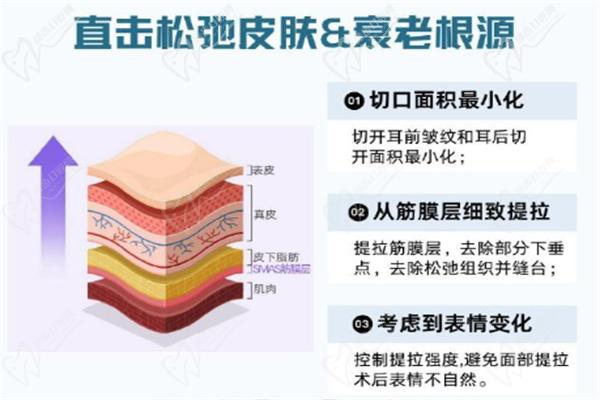 倪鋒醫(yī)生做拉皮怎么樣