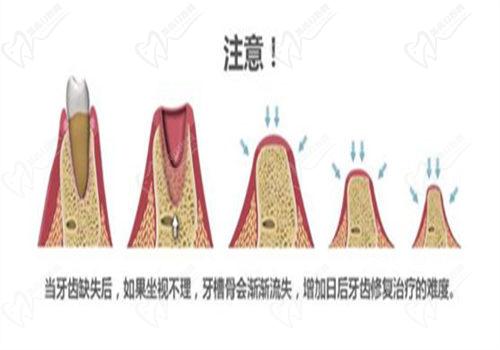 使用骨粉骨膜會有危害嗎?