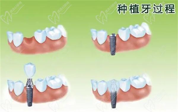 常州口腔醫(yī)院收費(fèi)價(jià)目表