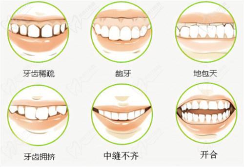 南寧柏樂口腔醫(yī)院牙齒矯正多少錢？