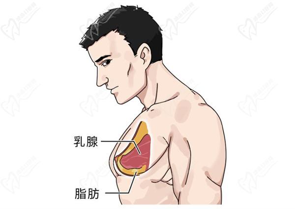 變性