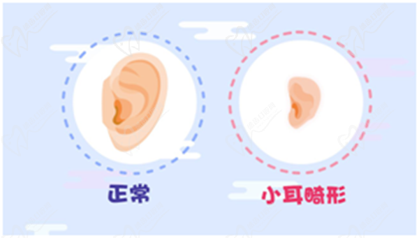 安波耳再造做了上萬臺手術(shù)