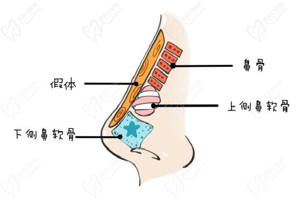 范榮杰做復雜鼻修復多少錢 + 病例