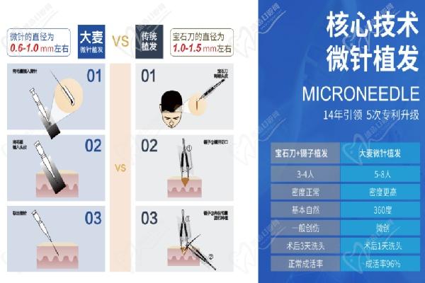 成都植發(fā)醫(yī)院哪家好怎么選