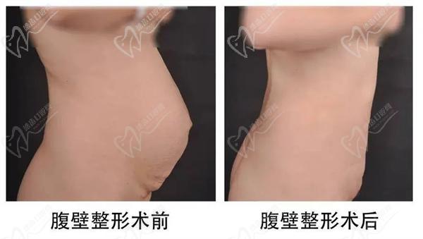 崔鑫醫(yī)生在哪家醫(yī)院
