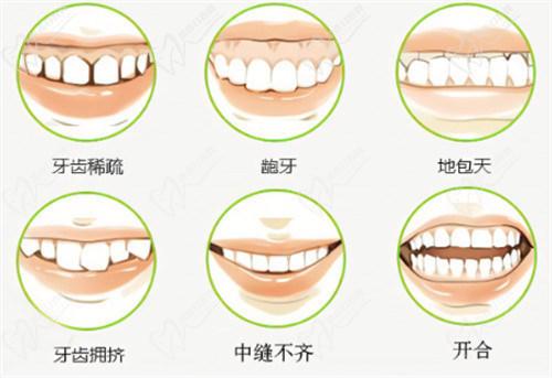 2025年國內牙齒矯正價格因矯正方式、醫(yī)院級別和地區(qū)差異而有所不同