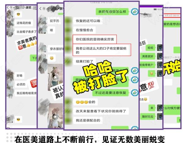 成都張航做垂胸提升怎么樣