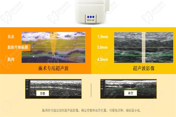 王飛醫(yī)生擅長(zhǎng)熱瑪吉與其他抗衰項(xiàng)目的聯(lián)合方案