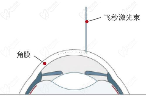 王曉瑛醫(yī)生在哪里出診？上海普瑞、上海和平等眼科醫(yī)院可預(yù)約