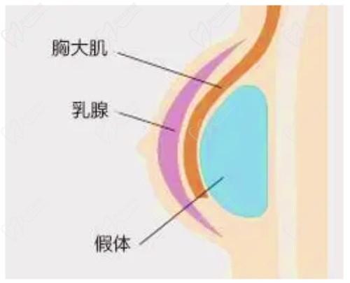 米蘭柏羽開啟胸部醫(yī)生面診日，穆大力、李英大親診做出精致自然美胸